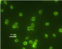 Cryptosporidium oocysts - source http://de.academic.ru/dic.nsf/dewiki/286758